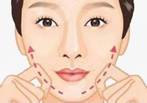 汕头曙光医疗美容门诊部瘦脸怎么样