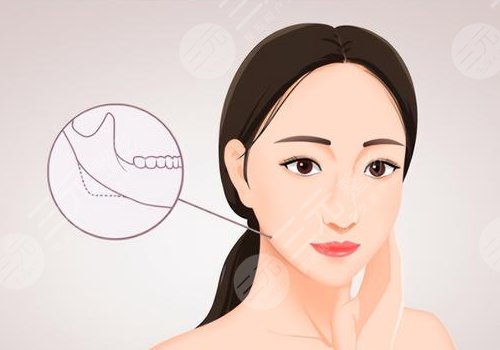 磨下颌骨手术一般多少钱