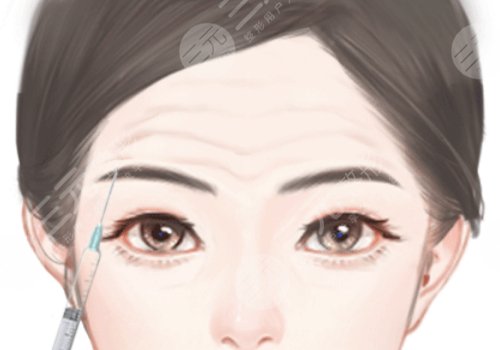 佛山华美整形美容医院除皱怎么样