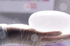 泊欧峰隆胸的价格是多少？有哪些医院可以做