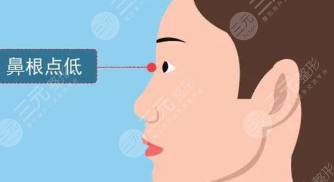 耳软骨隆鼻