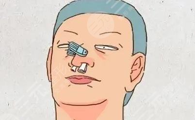 鼻外伤