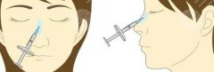 玻尿酸隆鼻一年后变宽是真的吗?怎么办?注射美鼻你得了解这些事! 玻尿酸隆鼻一年后变宽是真的吗?怎么办?注射美鼻你得了解这些事!