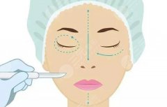 做拉皮有什么副作用吗？术前3大问题科普，除皱指南！