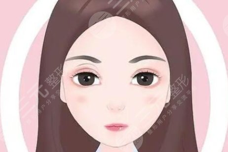 双眼皮