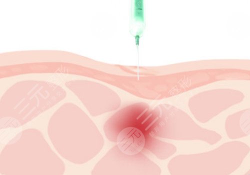 佛山华美整形美容医院祛疤效果好吗