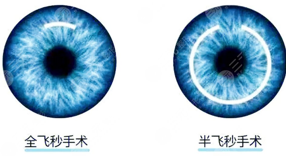 飞秒全飞秒.