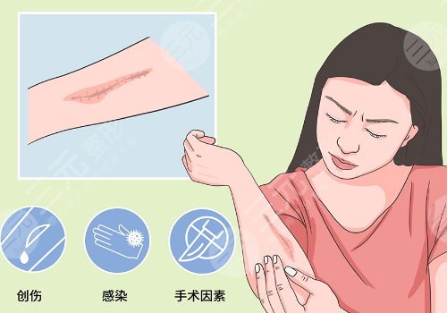 佛山南海唯科医疗门诊部祛疤怎么样