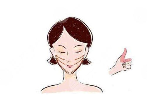 佛山南海唯科医疗门诊部玻尿酸多少钱