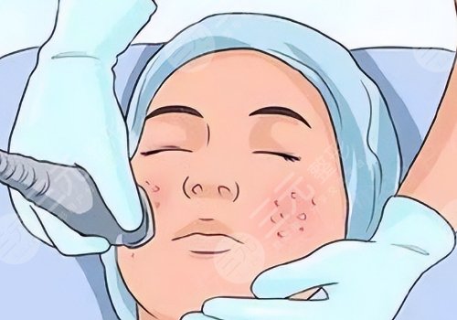 佛山市第二人民医院医学美容科祛斑多少钱