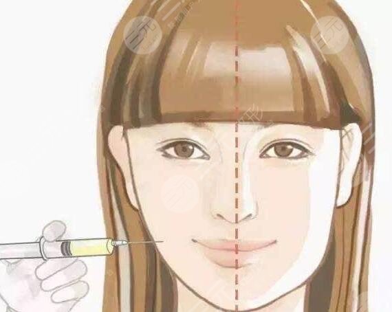 注射瘦脸