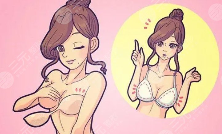 隆胸