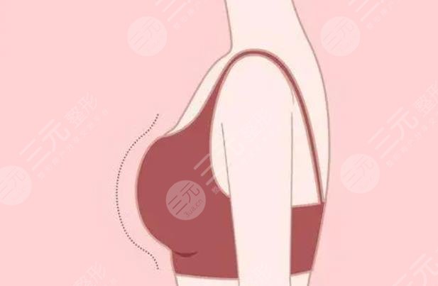 胸部注射物质取出