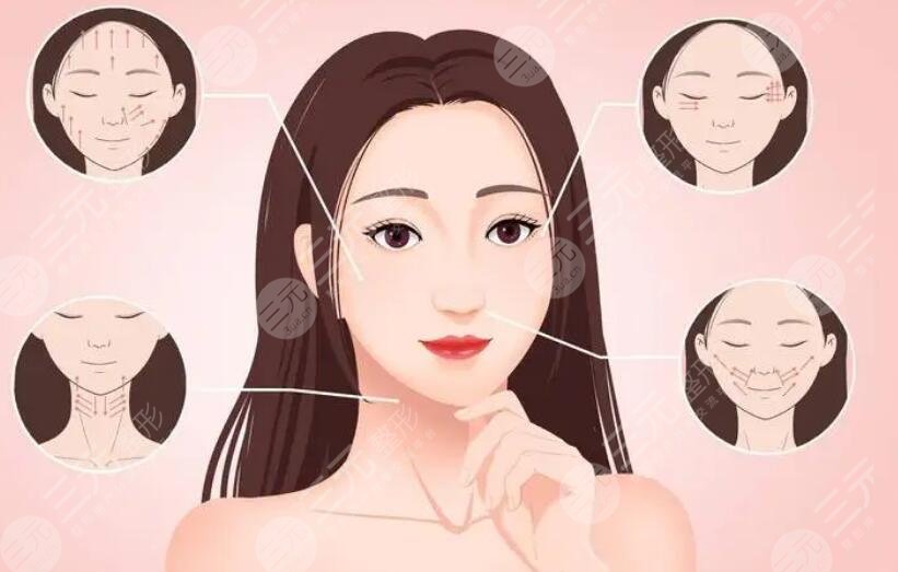 拉皮