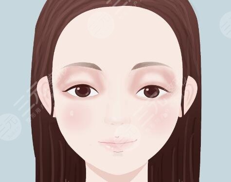 双眼皮