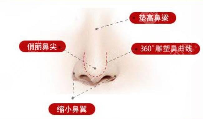 鼻综合