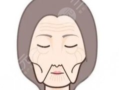 拉皮手术怎么做出来的？面部紧肤提升原理介绍，看看你适不适合！