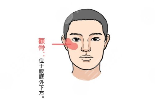 颧骨高磨骨手术需要多少钱