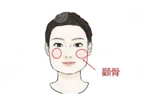 颧骨高磨骨手术需要多少钱