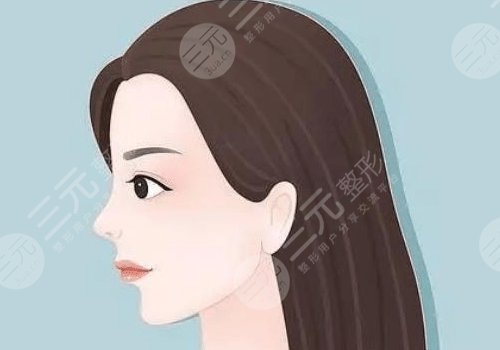 垫下巴整形多少钱