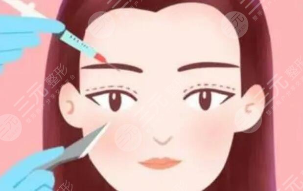双眼皮