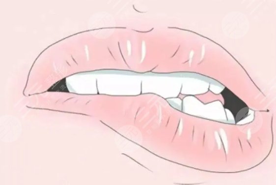 厚唇改薄