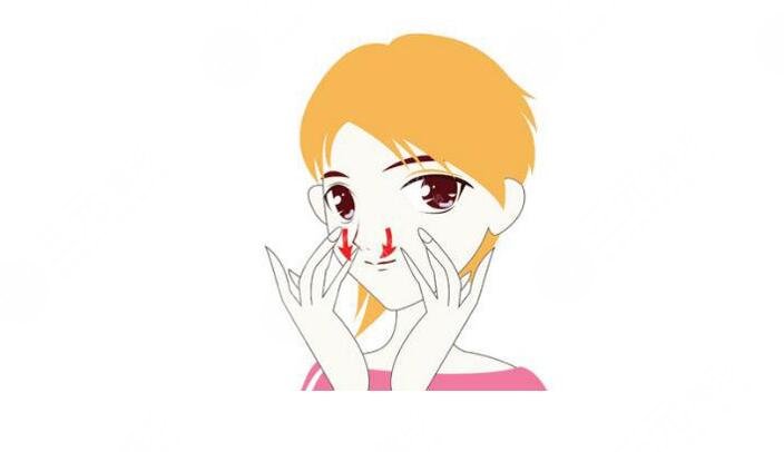 上海范荣杰鼻翼缩小案例分享