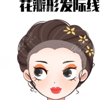 发际线