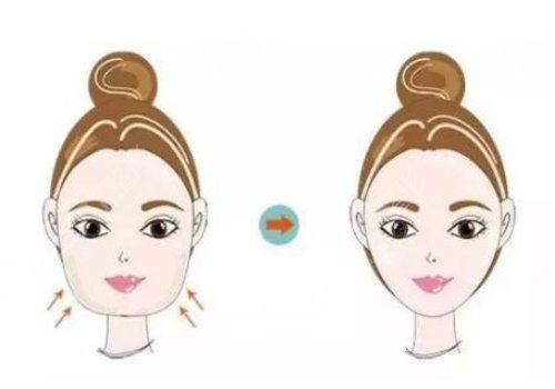 下颌骨突出怎么矫正