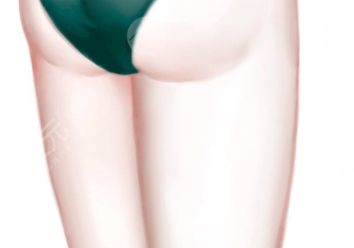 吸脂瘦大腿一般多少钱