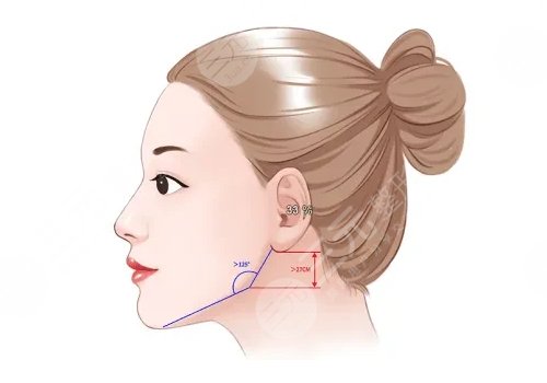 下颌角磨骨手术风险大吗