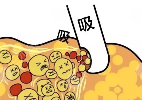 做一次医美大概多少钱