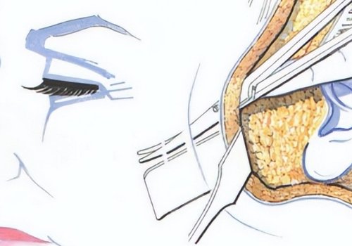 面部下垂好的医美手段