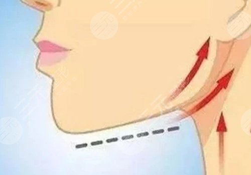 轮廓固定能维持多久