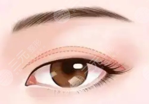 孔伟立是湘雅的医生吗