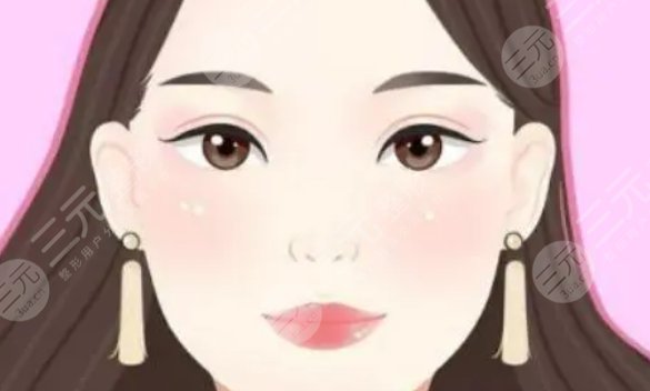 双眼皮