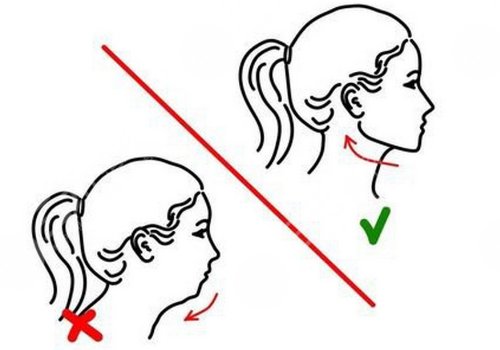 下颌骨后缩怎么矫正