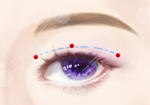 王彦进青医附院开扇怎么样