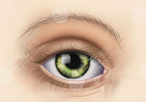 黎慧娟双眼皮医生从业经历