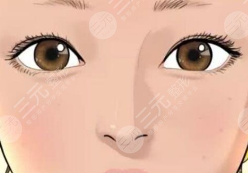 姜留刚双眼皮案例怎么样的