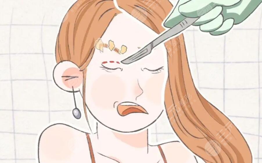 双眼皮