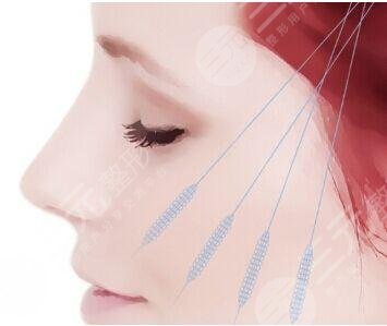 欣菲聆玻尿酸属于什么档次