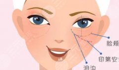 眼袋泪沟太重了有什么方法?医美轻松搞定,科普来了! 眼袋泪沟太重了有什么方法?医美轻松搞定,科普来了!