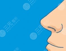 缩小鼻孔的方法有哪些?手术原理科普,重塑精致俏鼻! 缩小鼻孔的方法有哪些?手术原理科普,重塑精致俏鼻!