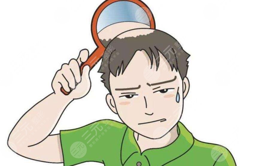 植发