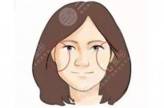 颧骨内推手术多少钱?价格大概35000元到98000元不等! 颧骨内推手术多少钱?价格大概35000元到98000元不等!
