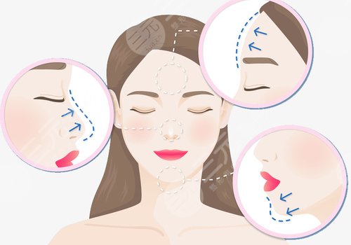 什么是轮廓固定抗衰