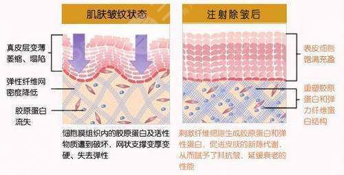法思丽玻尿酸属于什么档次?