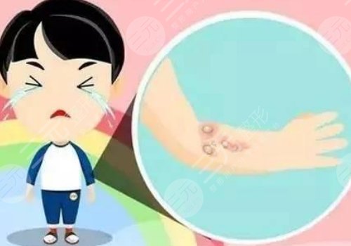 苏州附二院祛疤怎么样