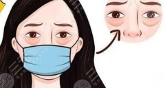 去眼袋好的方法医美推荐!3种方法搞定显老元凶! 去眼袋好的方法医美推荐!3种方法搞定显老元凶!
